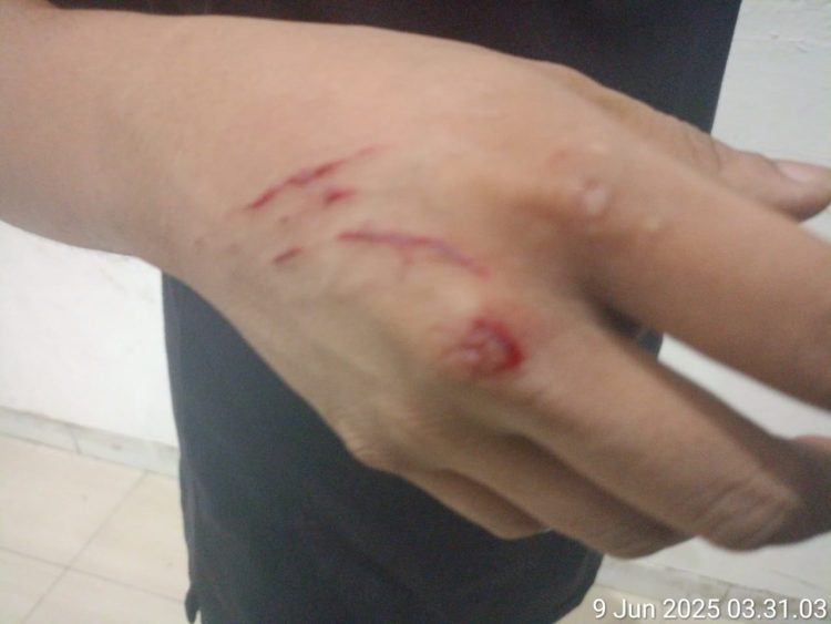 Wartawan Dipukuli Orang Tak Dikenal di Cafe Bmart Kemayoran Jakpus