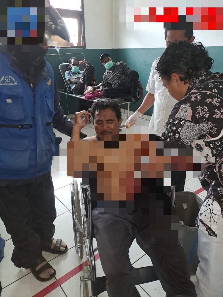 Aksi Brutal OTK di Puncak Jaya, Korban Luka Parah Akibat Kekerasan Menggunakan Senjata Tajam
